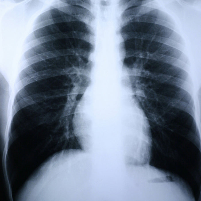 X-Ray Film