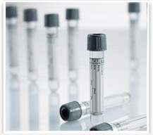 Venous Blood Collection Tube