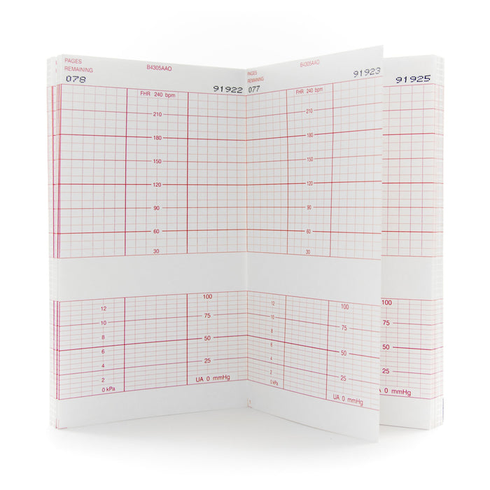 Fetal Monitor Recording Paper