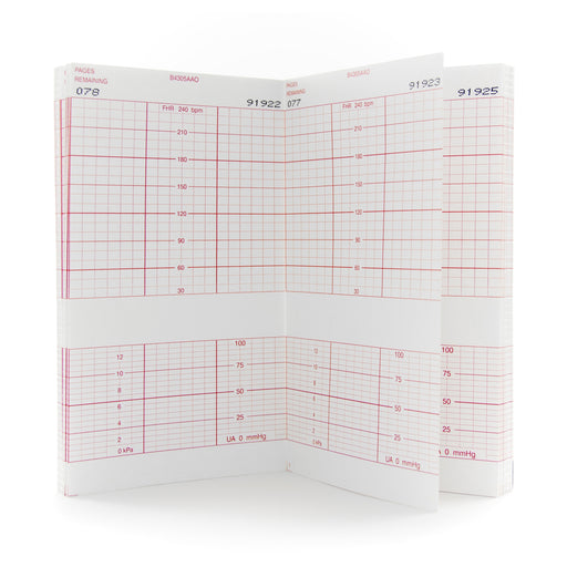 Fetal Monitor Recording Paper