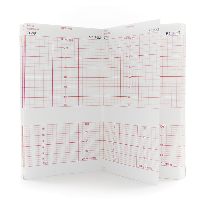 Fetal Monitor Recording Paper