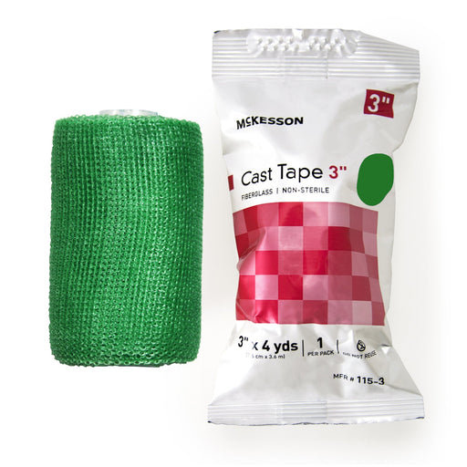 Cast Tape