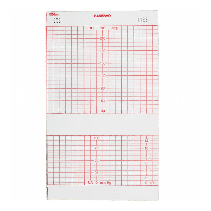 Fetal Monitor Recording Paper