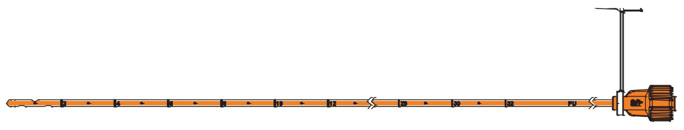 Enteral Feeding Tube