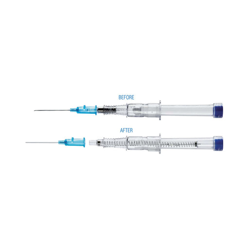 Peripheral IV Catheter