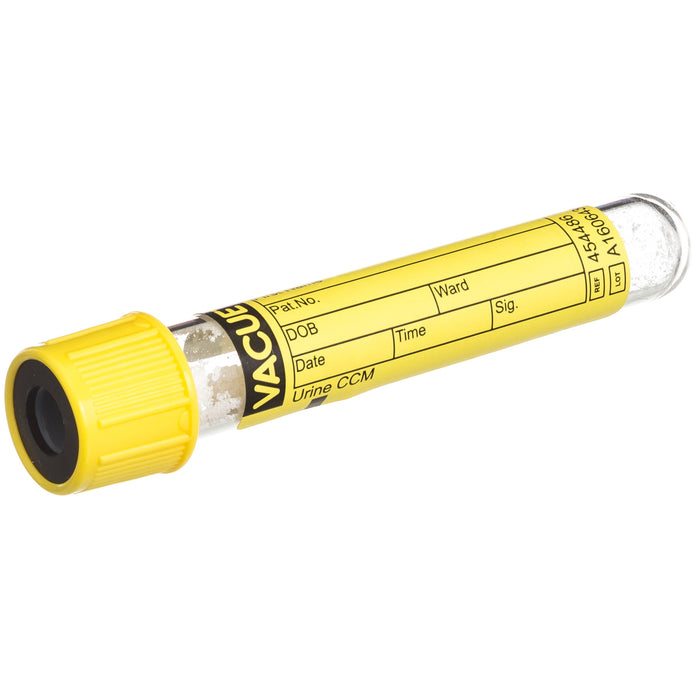 Urinalysis Tube