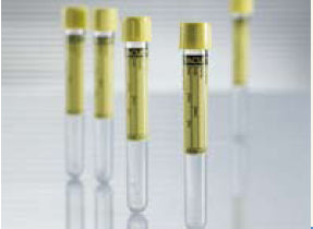 Urinalysis Tube