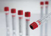 Venous Blood Collection Tube