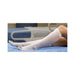 Anti-embolism Stocking