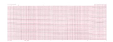 Diagnostic ECG Recording Paper