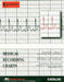 Diagnostic ECG Recording Paper