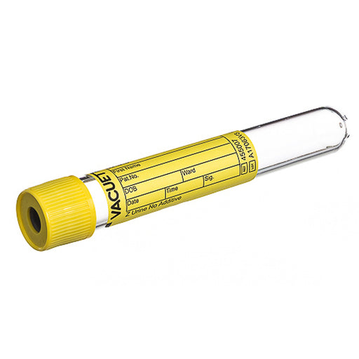 Urinalysis Tube